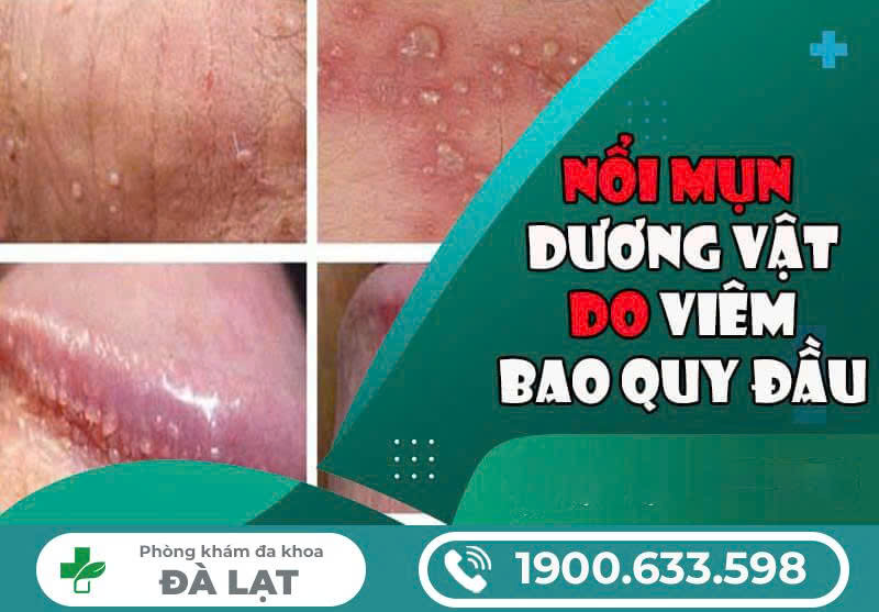 Hình ảnh minh họa